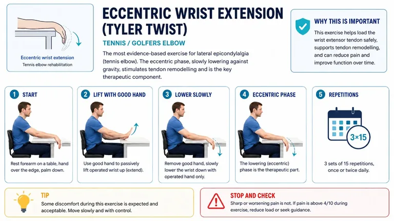 Eccentric wrist extension (Tyler Twist)