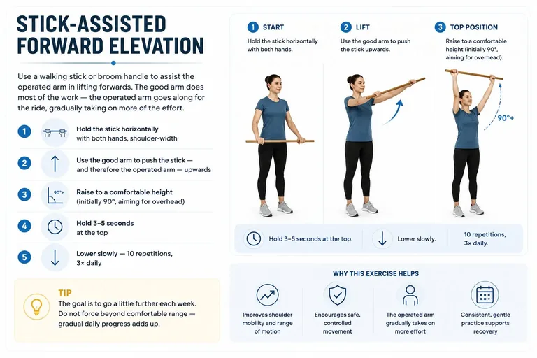 Stick-assisted forward elevation